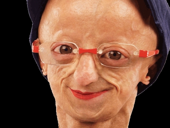 Progeria89
